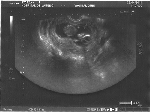 Offspring0002 Sonogram